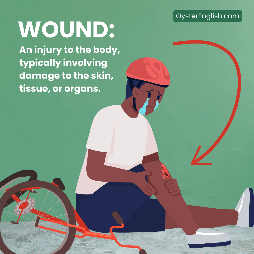 Wound definition